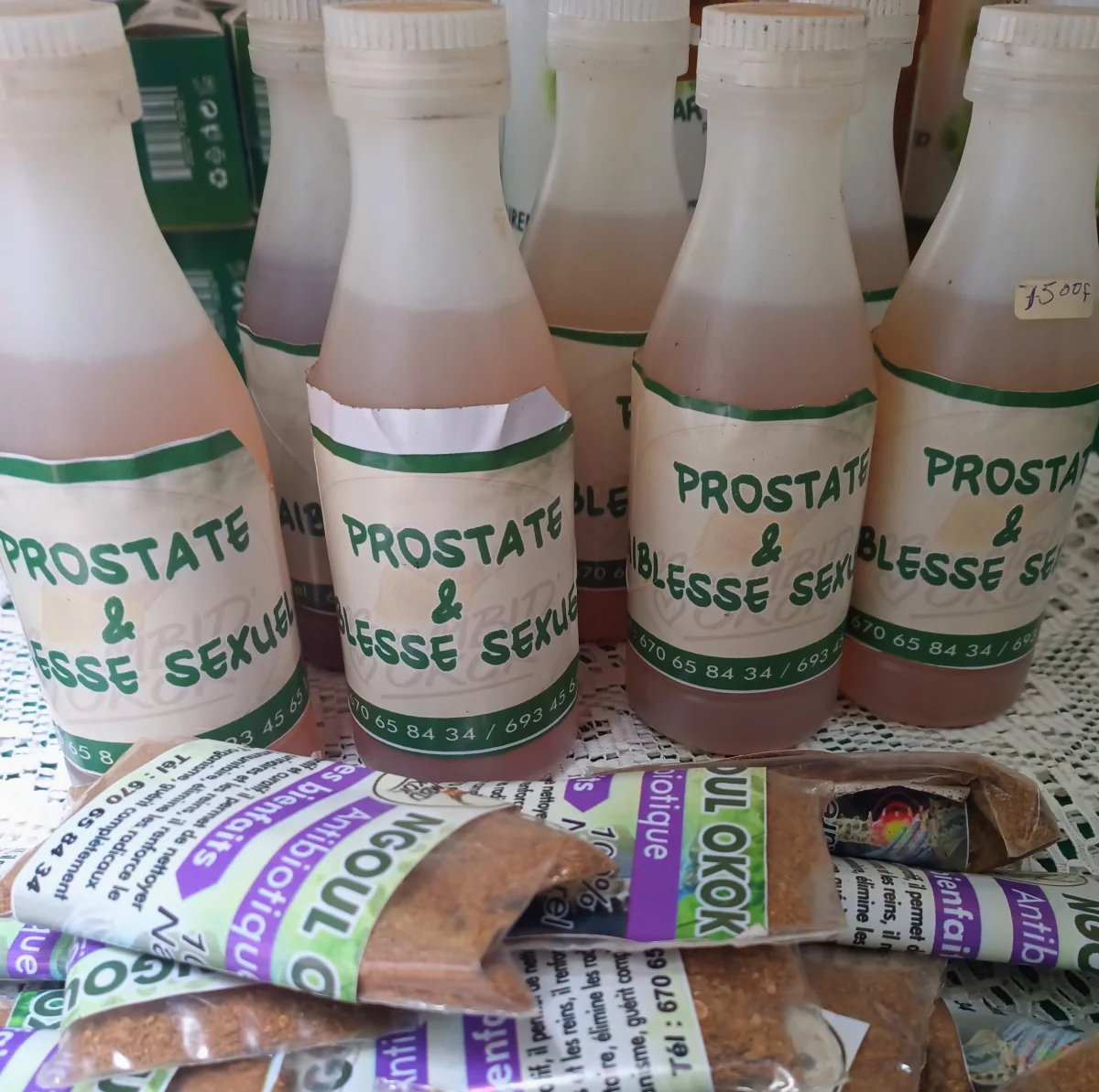 Prostate et faiblesse Sexuel